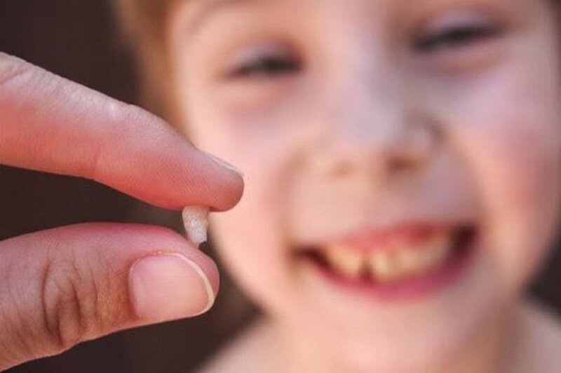 Phụ huynh có thể lựa chọn cách nhổ răng tại nhà cho bé hoặc nhổ răng tại nha khoa