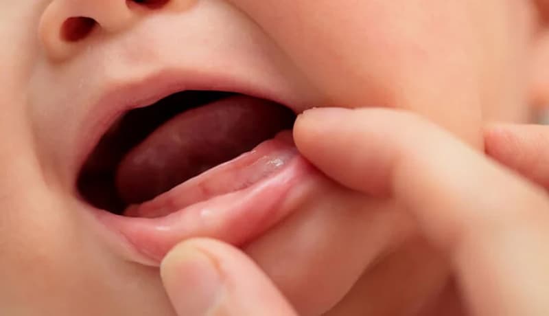 Việc thiếu canxi hay hấp thụ vitamin kém cũng là yếu tố khiến răng bé mọc chậm