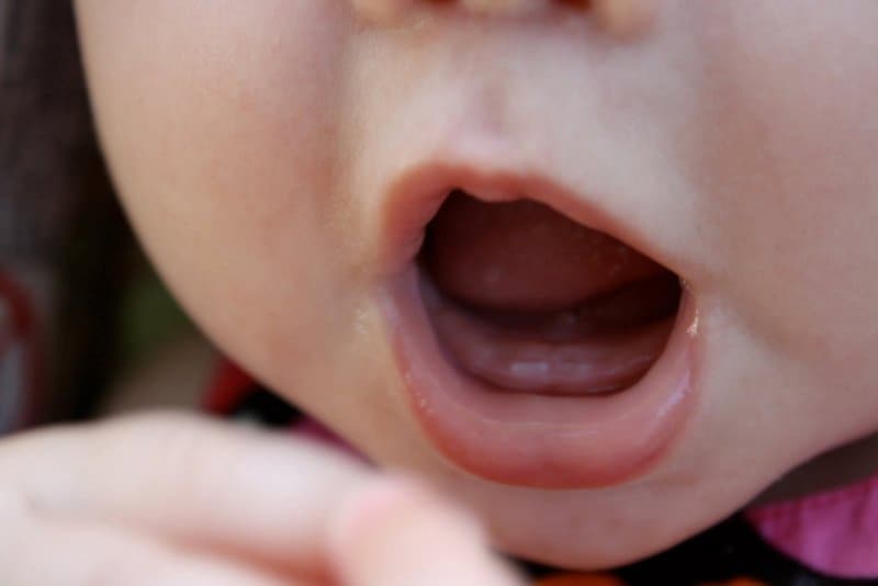 Trẻ 7 tháng chưa mọc răng xuất phát từ rất nhiều nguyên nhân