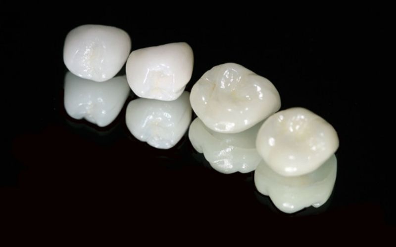 Răng sứ thủy tinh Emax có màu sắc y như răng thật