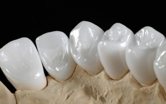 Răng có độ cứng hơn răng thật rất nhiều nên đảm bảo được khả năng ăn nhai