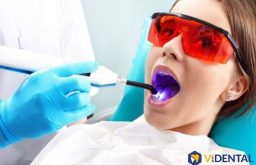Công nghệ trám răng Laser Tech là kỹ thuật hiện đại bậc nhất trong nha khoa thẩm mỹ