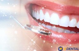 Công nghệ bọc răng sứ SUPERPLAS 6D độc quyền tại ViDental đang được khách hàng săn đón