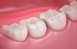 Răng hàm là gì? Chức năng và một số vấn đề thường gặp phải