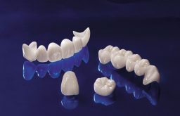 [Chuyên gia giải đáp chi tiết] Bọc răng sứ có hại không?
