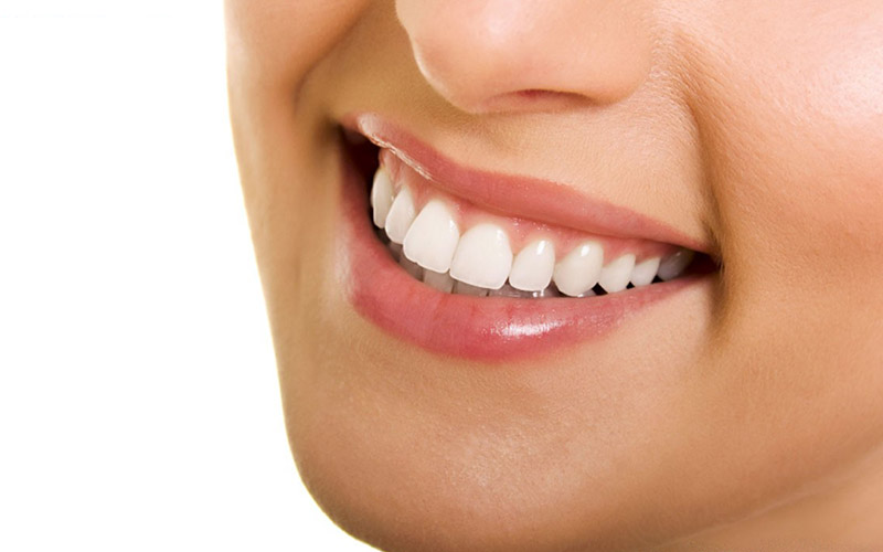 Những người muốn có hàm răng đẹp nhưng tài chính hạn hẹp có thể bọc răng sứ trả góp