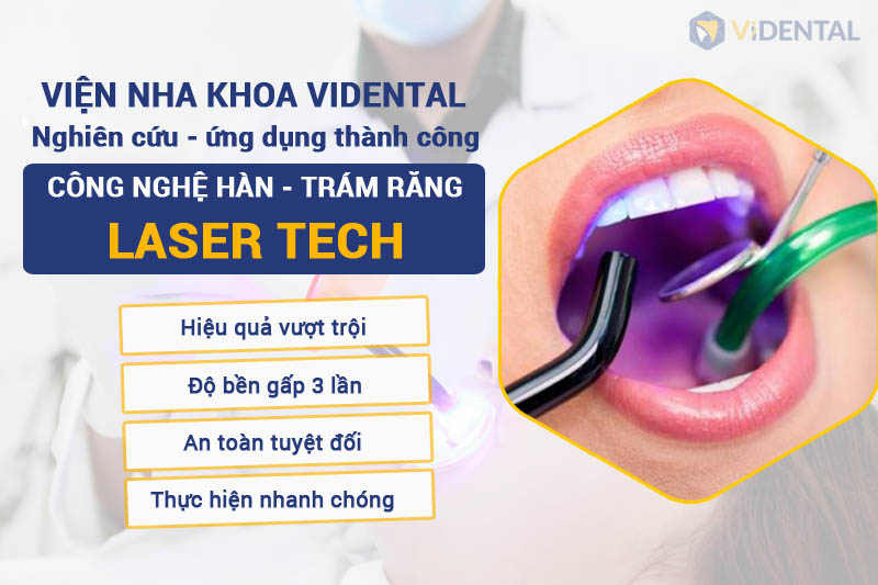 ViDental nghiên cứu công nghệ hàn trám răng Laser Tech
