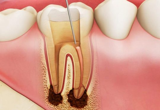 Tủy răng: Cấu tạo, chức năng và một số bệnh lý thường gặp