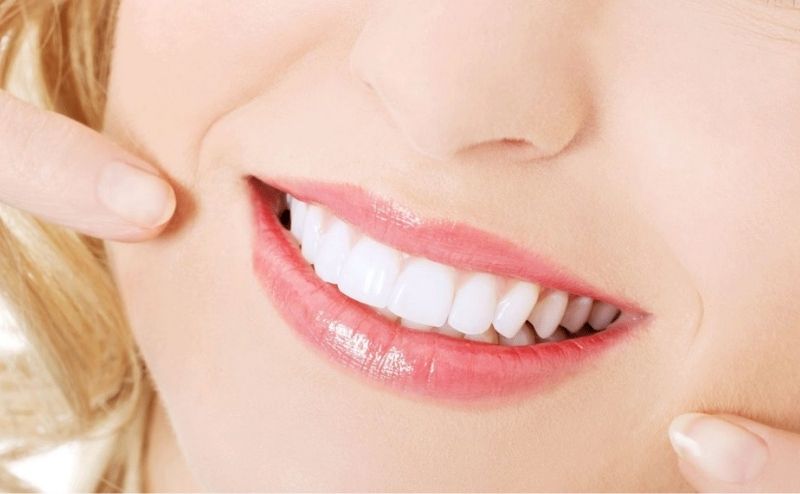 Các bước cụ thể trong quy trình tẩy trắng răng tại nha khoa