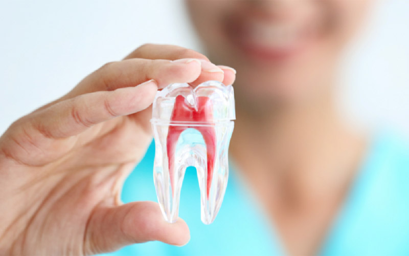 Quy trình điều trị tủy răng gồm 5 bước