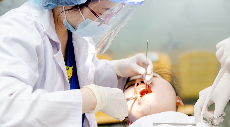 Nhổ răng khôn hàm trên là tiểu phẫu đơn giản, ít gặp biến chứng