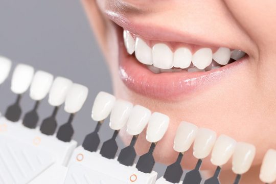 Trồng răng sứ vĩnh viễn giúp đảm bảo sức khỏe răng miệng và tính thẩm mỹ