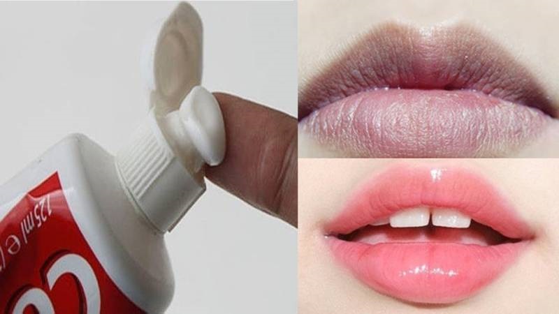Dùng kem đánh răng tẩy da chết trên môi là cách được nhiều chị em áp dụng