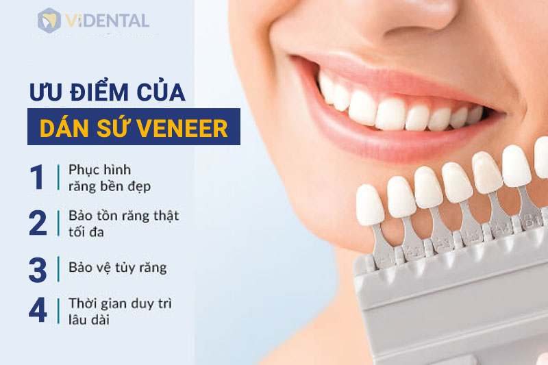 Dán sứ Veer là giải pháp khắc phục nhanh chóng các khuyết điểm trên răng 