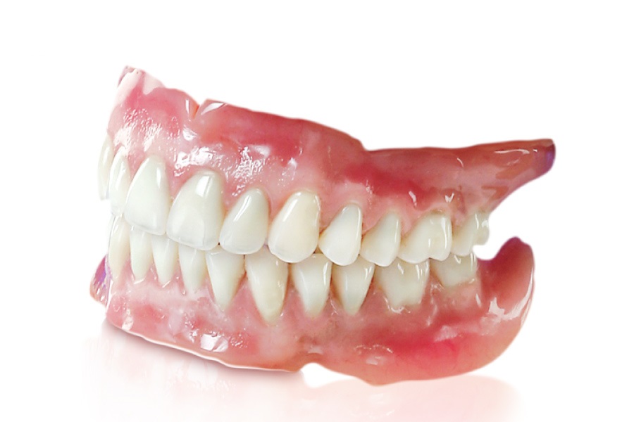 Giá trồng răng giả bằng hàm tháo lắp thấp hơn nhiều so với cầu răng sứ và cấy ghép Implant