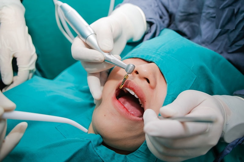Cấy ghép Implant là hình thức trồng răng giả tốn kém nhiều thời gian 