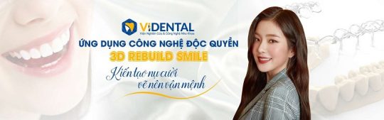 Công nghệ thiết kế nụ cười Rebuild Smile tại Vidental