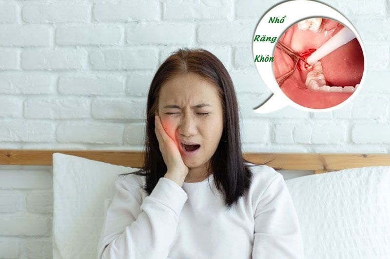 Nhiễm trùng huyệt ổ răng gây phản ứng sưng đau lan rộng