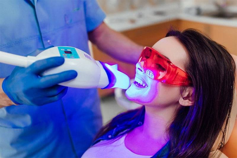 Phương pháp tẩy trắng răng an toàn bằng Laser