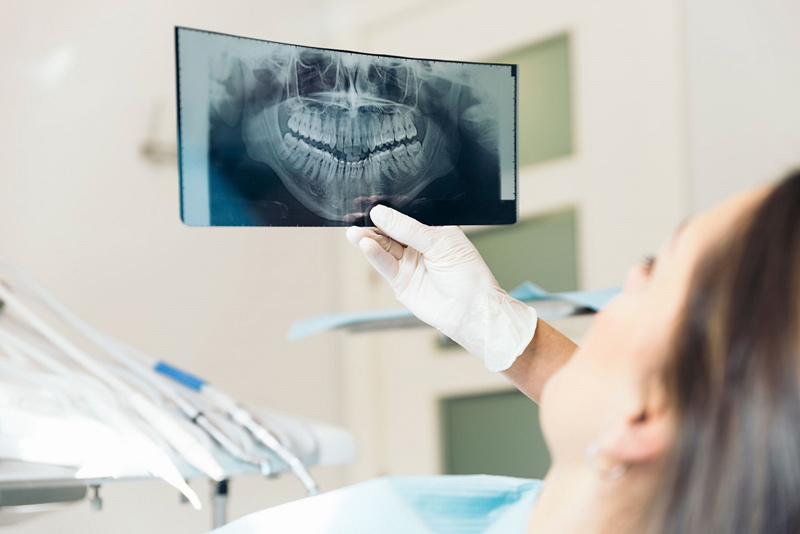 Quy trình trồng răng Implant phải có bước chụp X-quang đánh giá tình hình răng của bệnh nhân
