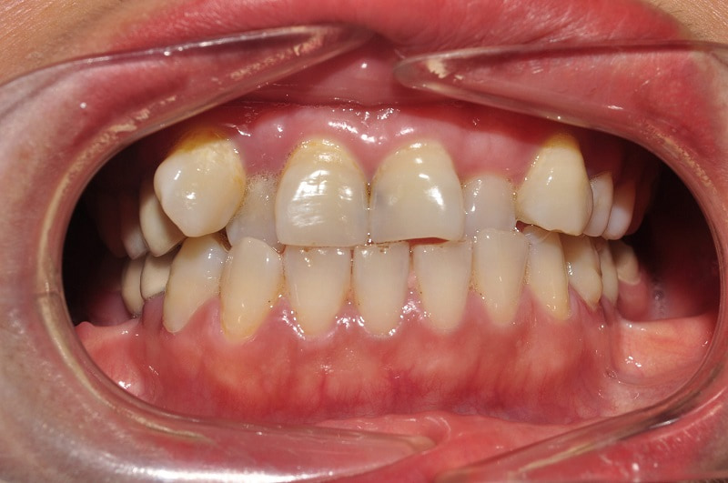 Hình ảnh hàm răng 9630