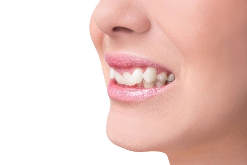 Phụ nữ hay nam giới đều không có nhân tướng học tốt khi sở hữu hàm răng này