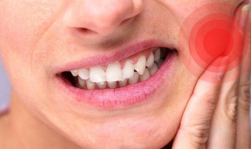 Bất cứ răng nào trên cung hàm bị sâu nếu không điều trị sớm sẽ gây ra những cơn đau nhức dữ dội