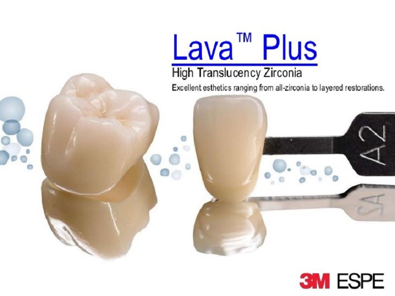 Dòng răng sứ Lava Plus 3M ESPE