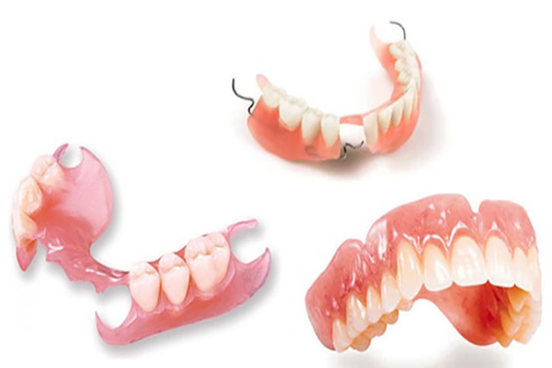 Thủ thuật trồng răng giả cũng tiềm ẩn một số mối nguy hại nhất định về răng miệng