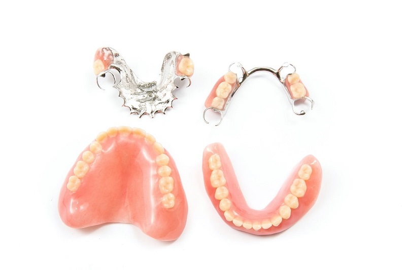 Hàm giả tháo lắp giúp phục hình nhiều răng hoặc toàn bộ răng đã mất một cách hiệu quả