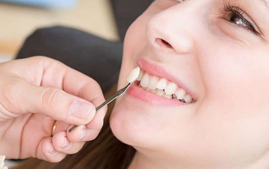 Trồng răng nanh bao nhiêu tiền được nhiều người thắc mắc đặt ra khi không may bị mất răng, răng kém thẩm mỹ