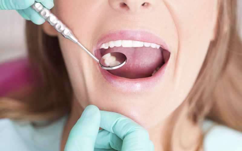 Bọc răng sứ bị cộm có thể gây ra nhiều bệnh lý về răng miệng