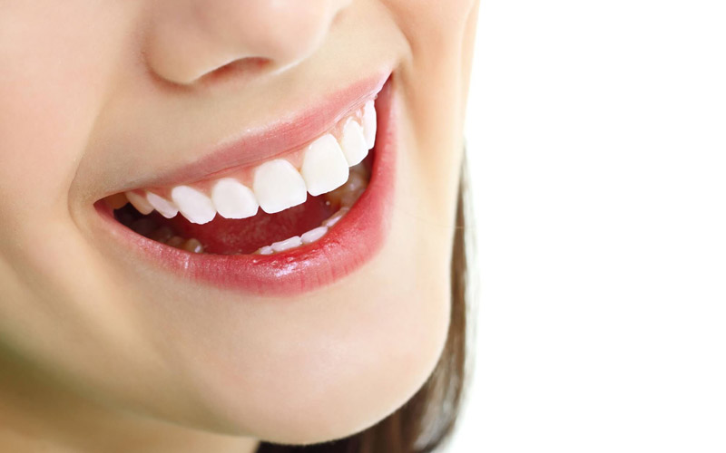 Bọc răng sứ là phương pháp nha khoa thẩm mỹ giúp đem lại một hàm răng đều đẹp