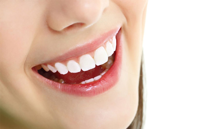 Răng sứ không được chăm sóc đúng cách rất dễ gây nên một số bệnh lý răng miệng
