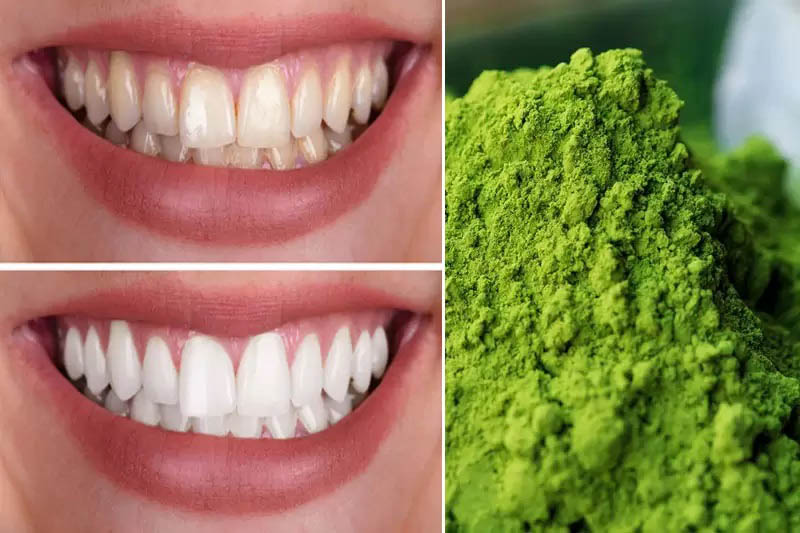 Trà xanh không chỉ giúp loại bỏ vết ố vàng mà còn phòng bệnh về răng miệng