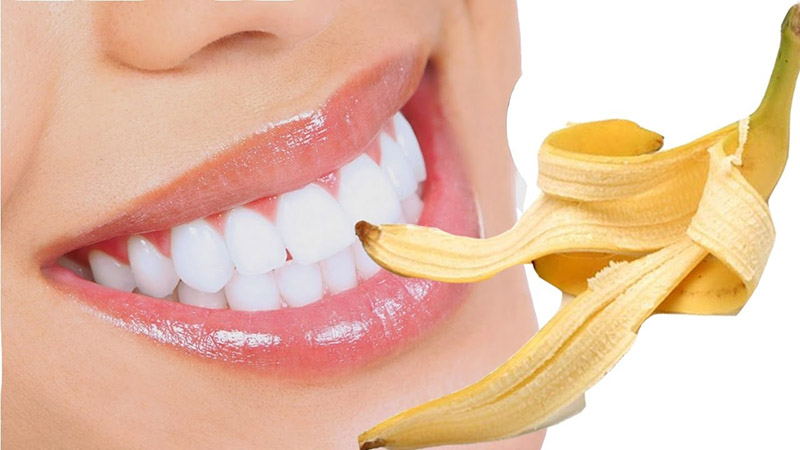 Tẩy trắng răng tại nhà bằng vỏ chuối dễ thực hiện, hiệu quả cao