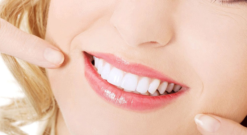 Dùng thuốc tẩy trắng răng tại nhà là giải pháp hoàn hảo cho những ai bận rộn
