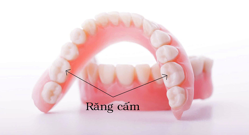 Răng cấm còn được gọi là chiếc răng cối lớn, nằm ở vị số 6 và 7 trên cung hàm
