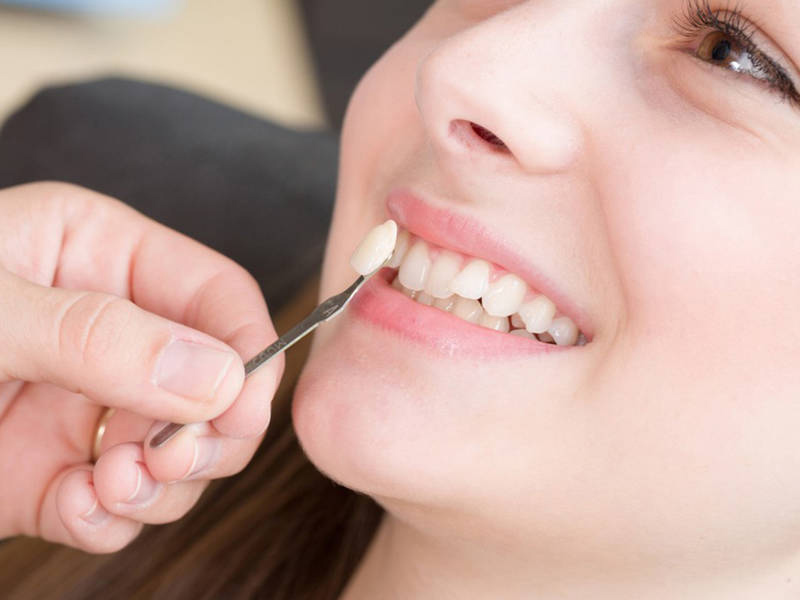 Trồng răng khểnh có đau không phụ thuộc vào nhiều yếu tố khác nhau
