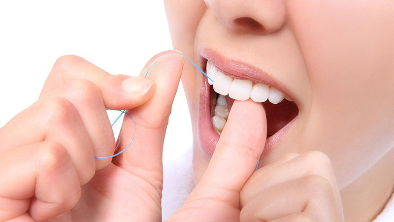 Trồng răng khểnh xong hãy vệ sinh răng miệng sạch sẽ để tránh nhiễm trùng
