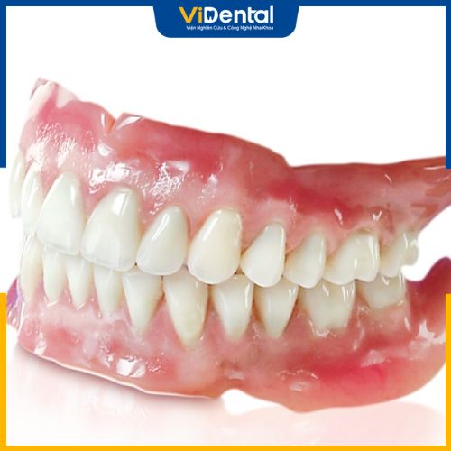 Giá trồng răng giả bằng hàm tháo lắp thấp hơn nhiều so với cầu răng sứ và cấy ghép Implant