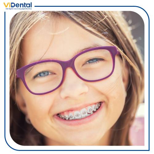 Độ tuổi chỉnh nha cũng là yếu tố ảnh hưởng đến chi phí khi niềng răng 1 hàm