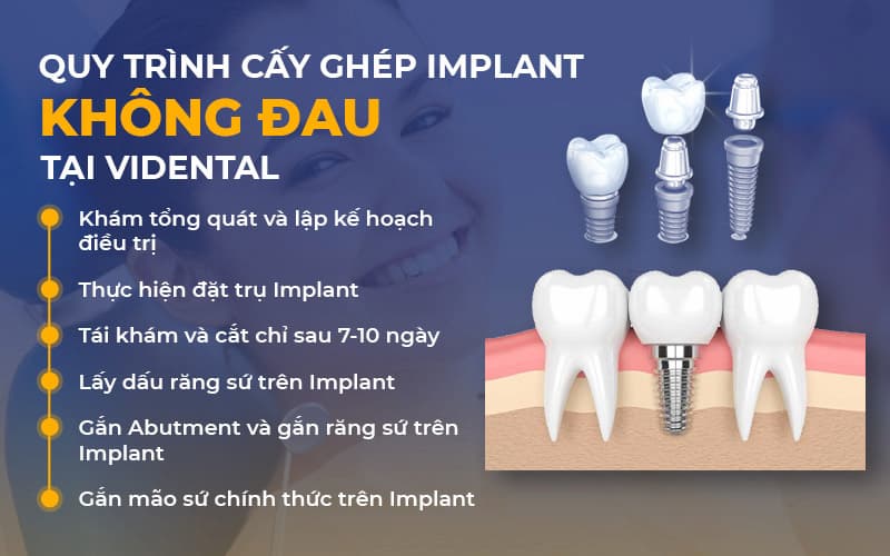 Trồng răng Implant tại Vidental đảm bảo chất lượng cao, không đau, không sưng, không gây hôi miệng sau trồng