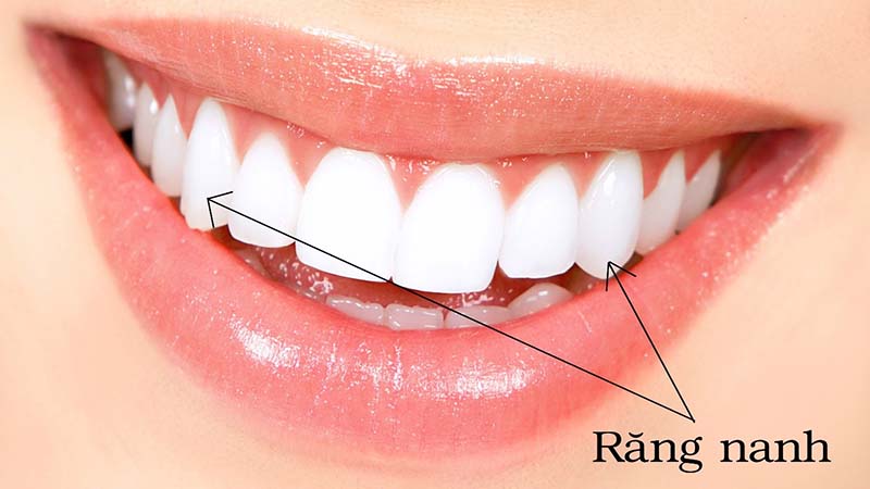 Răng nanh không chỉ đảm nhận chức năng ăn nhai, thẩm mỹ mà còn nâng đỡ cho toàn khung mặt