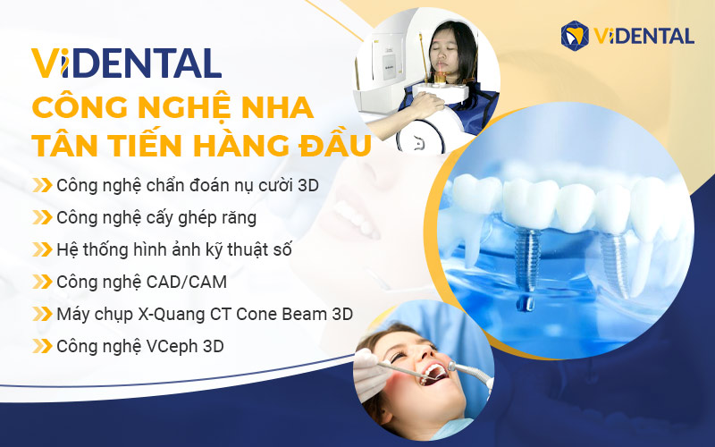 trồng răng tại Trung Tâm ViDental Implant ứng dụng công nghệ hiện đại