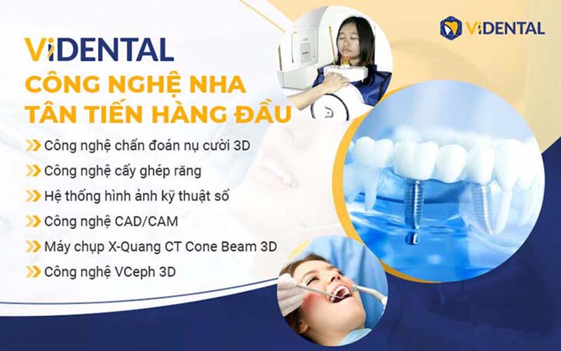 Trung tâm trồng răng phục hình thẩm mỹ Vidental mang tới nụ cười tự tin cho người bệnh bằng công nghệ, kỹ thuật hiện đại