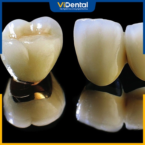 Cầu răng sứ Titan là phương pháp phục hình răng hiệu quả và an toàn