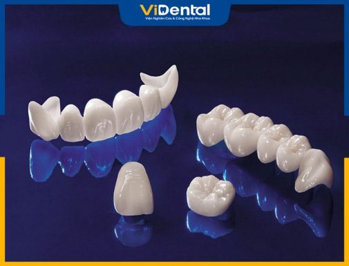 Cầu răng sứ Titan có nhiều ưu điểm vượt trội như an toàn, chi phí rẻ