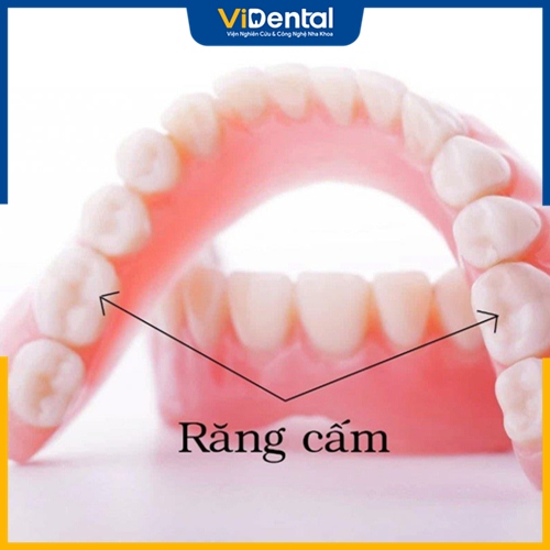 Răng số 6 còn gọi là răng cấm, có chức năng nhai chính trên cung hàm