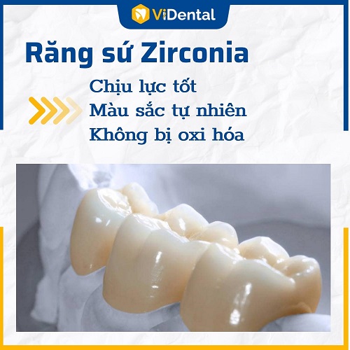 Chất liệu răng sứ sử dụng là loại cao cấp nhất